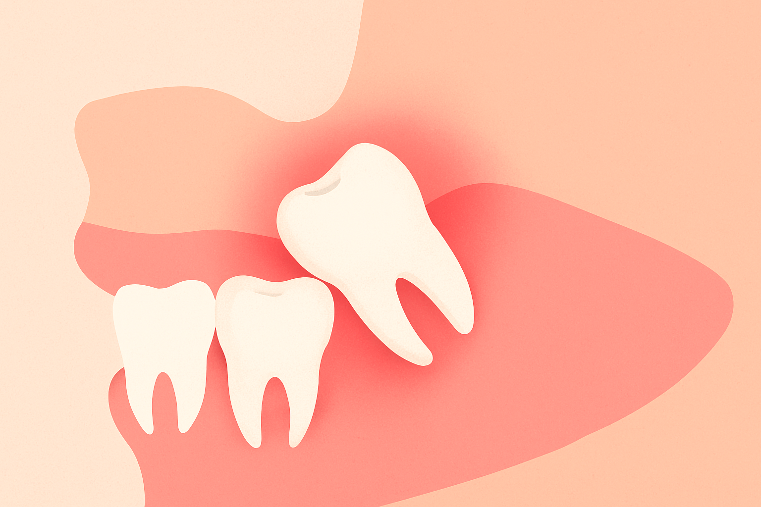 Featured image for How to Know If Your Wisdom Tooth Is Growing Wrong