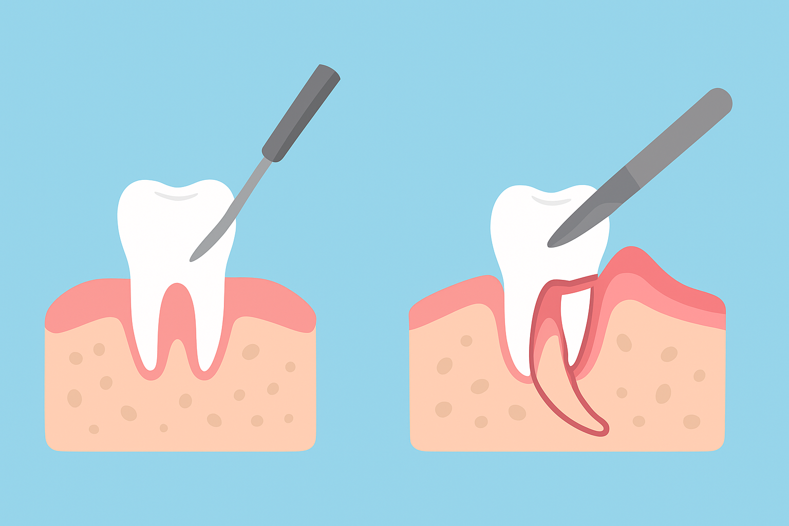 Featured image for Simple vs. Surgical Extractions: What’s the Real Difference?