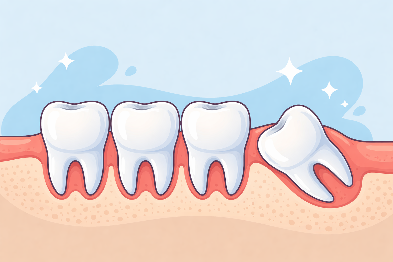 Featured image for Wisdom Teeth vs. Other Molars: What’s the Real Difference?