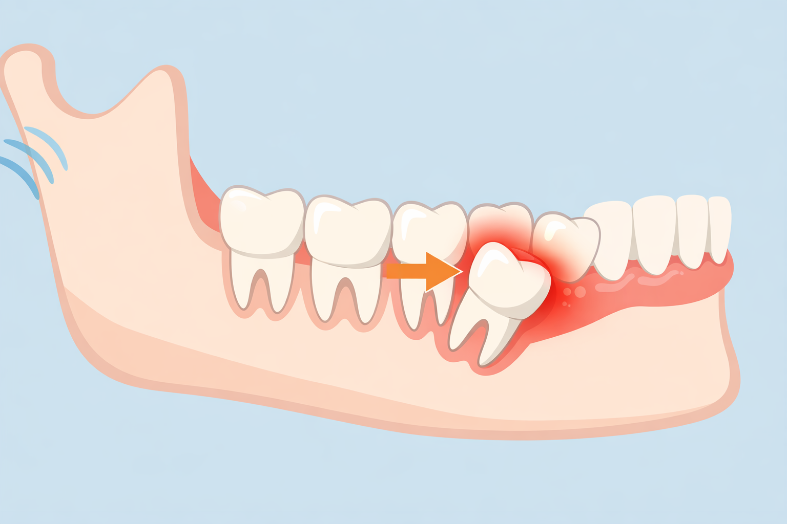 Featured image for What Really Happens If You Don’t Remove Problem Wisdom Teeth