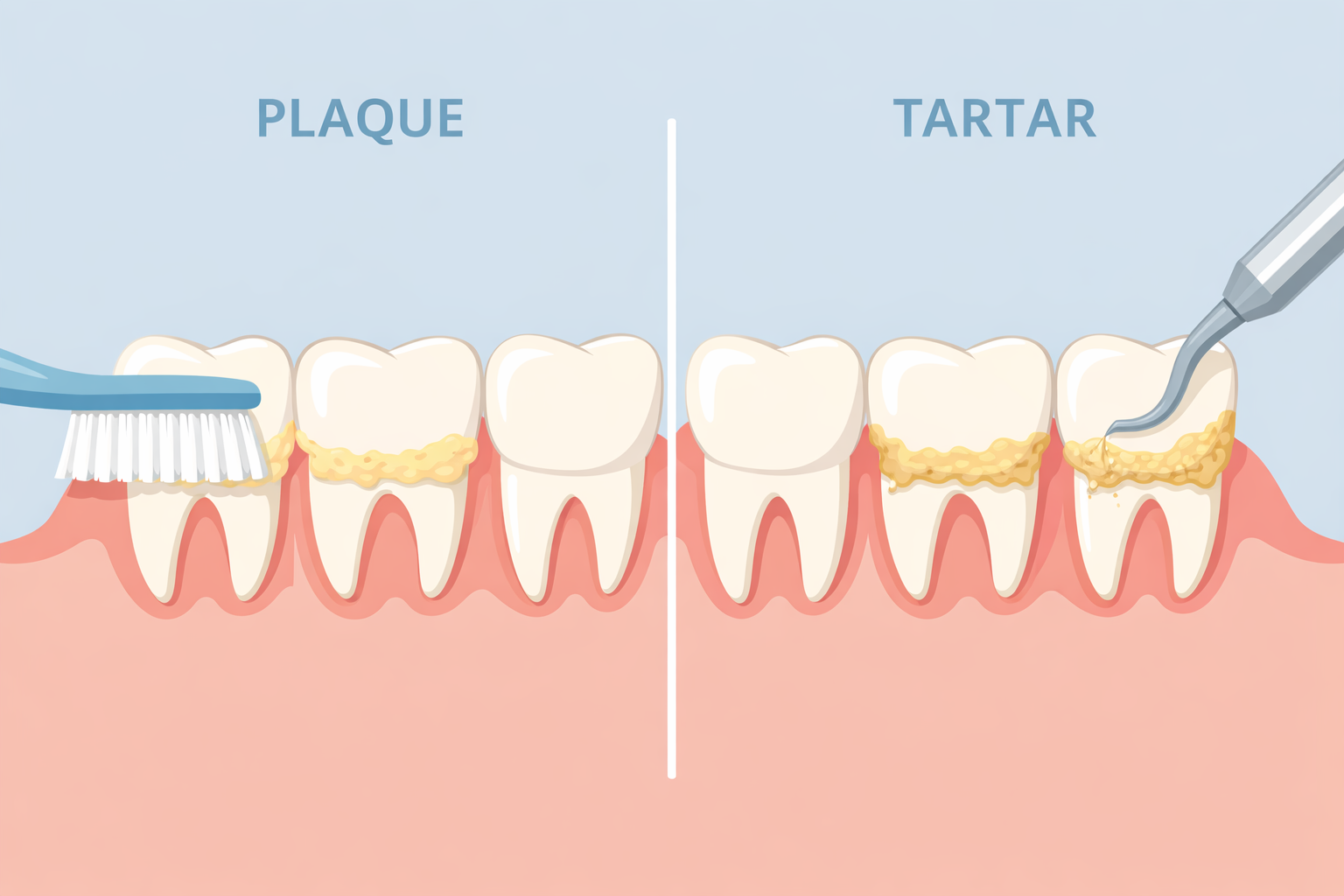 Featured image for Plaque vs. Tartar: What’s the Difference?